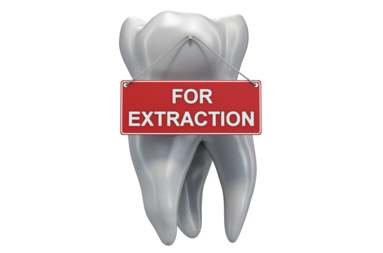 A 3D illustration of a tooth with a 'For Extraction' sign, representing necessary dental extractions.